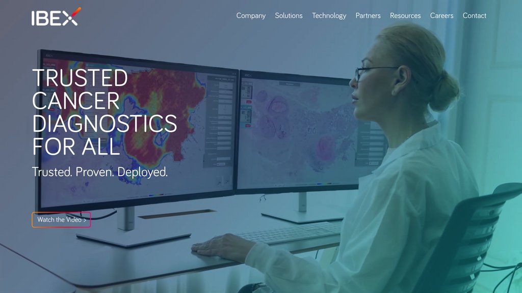 Ibex Medical Analytics preview